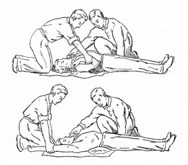 Search photos &quot;silvester method&quot;