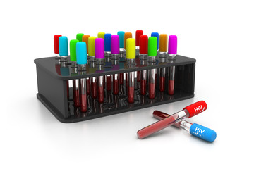 HIV Blood test , Blood In tube for laboratory analysis