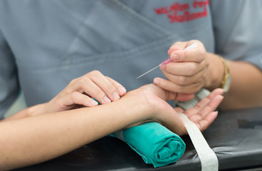 open radial artery for arterial line monitor