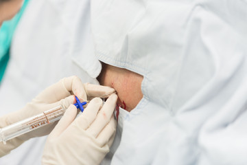 epidural analgesia