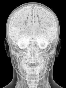 X-ray view of human head isolated on black