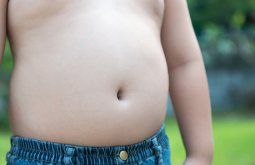 Naklejka premium the size of stomach of children with overweight.