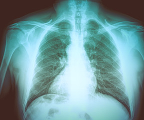 Retro look Medical X-rays