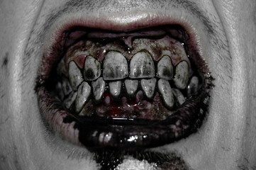 Zombie teeth