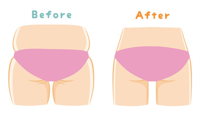 ダイエット　ヒップ