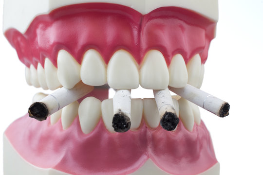 Teeth and cigarettes