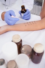 Obraz na płótnie Canvas Doctor carrying out a skin prick test