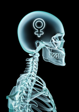 X-ray female thinking