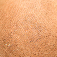 dirty background of human skin