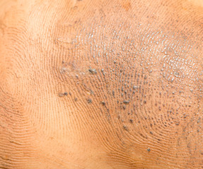 Fototapeta premium dirty background of human skin