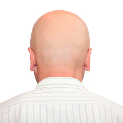 Fototapeta premium Hairless head with space for your text.
