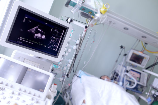 Screen with the image of heart ultrasound in a hospital ward