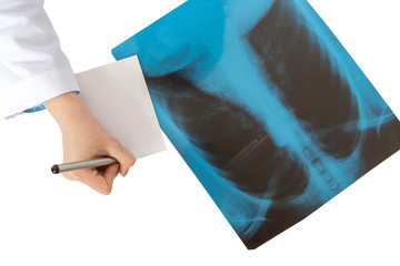 Doctor writing description of X-ray scan of human lungs