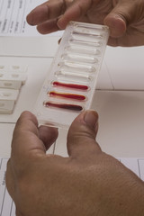 Real action to blood analysis - no fiction