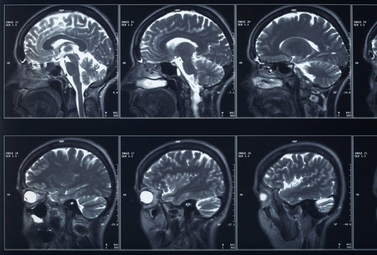 33 260 best brain xray images stock photos vectors adobe stock
