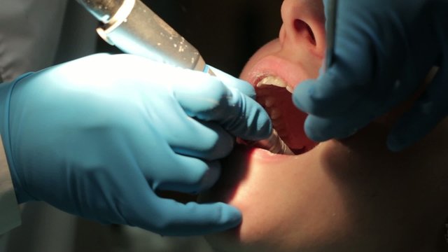 Dentist whiten your teeth in a patient