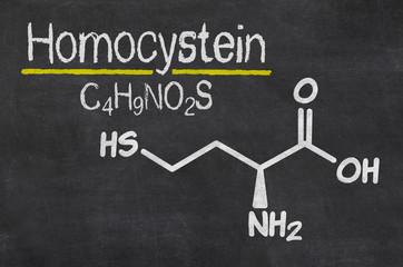 Schiefertafel mit der chemischen Formel von Homocystein