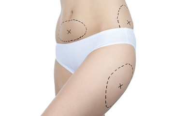 Photo of woman with problem zones