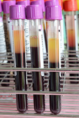 Medical test-tube with blood samples