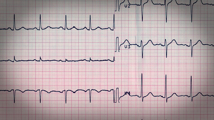 Retro look Electrocardiography of heart beat