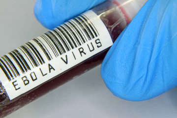 blood infected with ebola virus