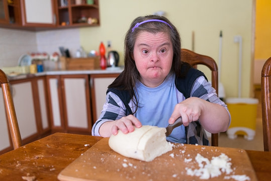 woman with down syndrome