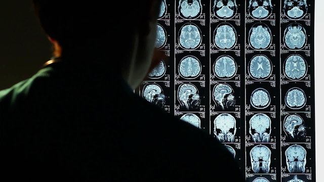 Head MRI,  surgeon observing skull brain x-ray film, analysis