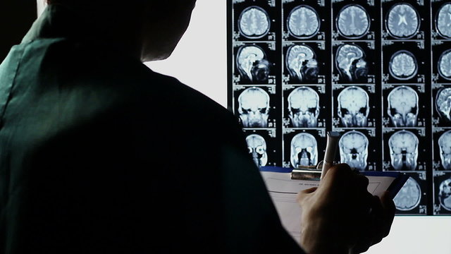 Examining scull brain X-ray scan, taking notes, making diagnosis