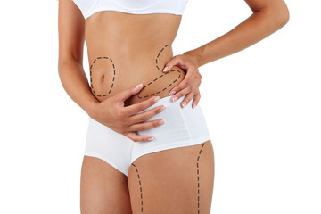 Plastic surgery. Liposuction. Slim body concept