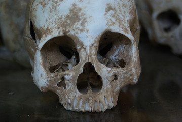 skull
