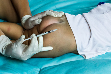 Injection