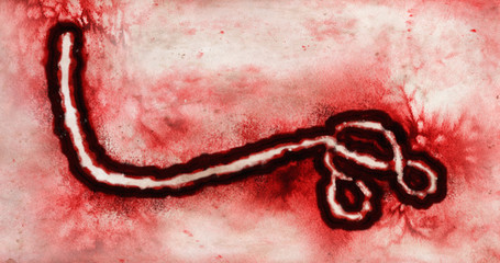 Microscopic view of Ebola Virus