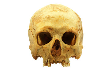 Genuine human skull isolated on white, lipids makes skull yellow