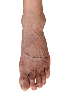 foot of elderly woman isolate on white background