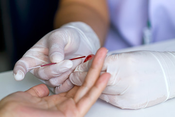 Blood test