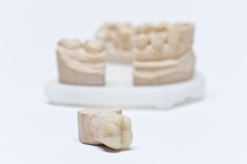 Calco per la capsula dentale