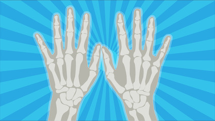 Hand X-Ray