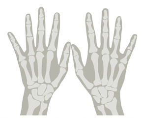 Obraz premium Hands X-Ray