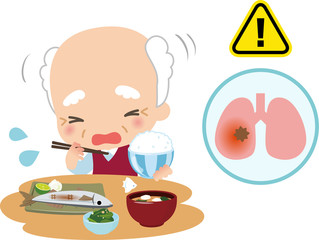 食事中にむせる高齢男性と肺炎イメージ
