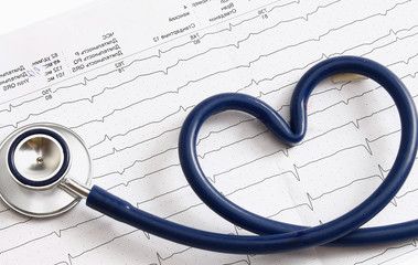 A stethoscope in a shape of heart lying on a cardiogram