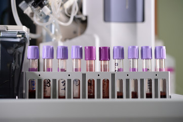 close up shot of blood test machine in laboratory