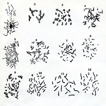 Pasteur's Drawings Of Bacteria And Yeast