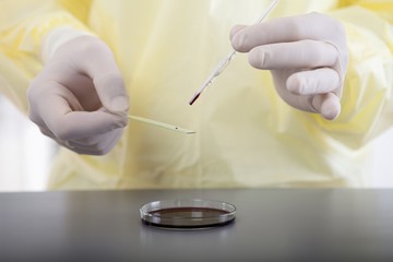laboratory pipette over Petri dishes filled with red