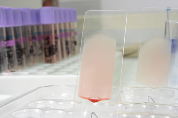blood testing in laboratory for microscope