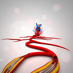Stent angioplasty procedure with placing a balloon