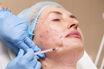 Cosmetic treatment with injection in a clinic