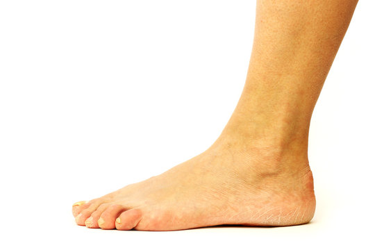 Woman leg on white background