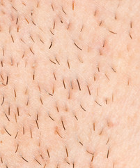 bristles on the skin. close-up