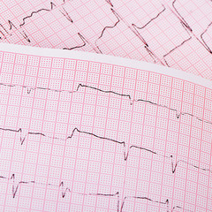 The tape with the cardiogram of a man
