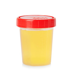 Urine sample in container
